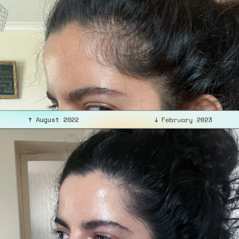 Hair Scalp Massager
