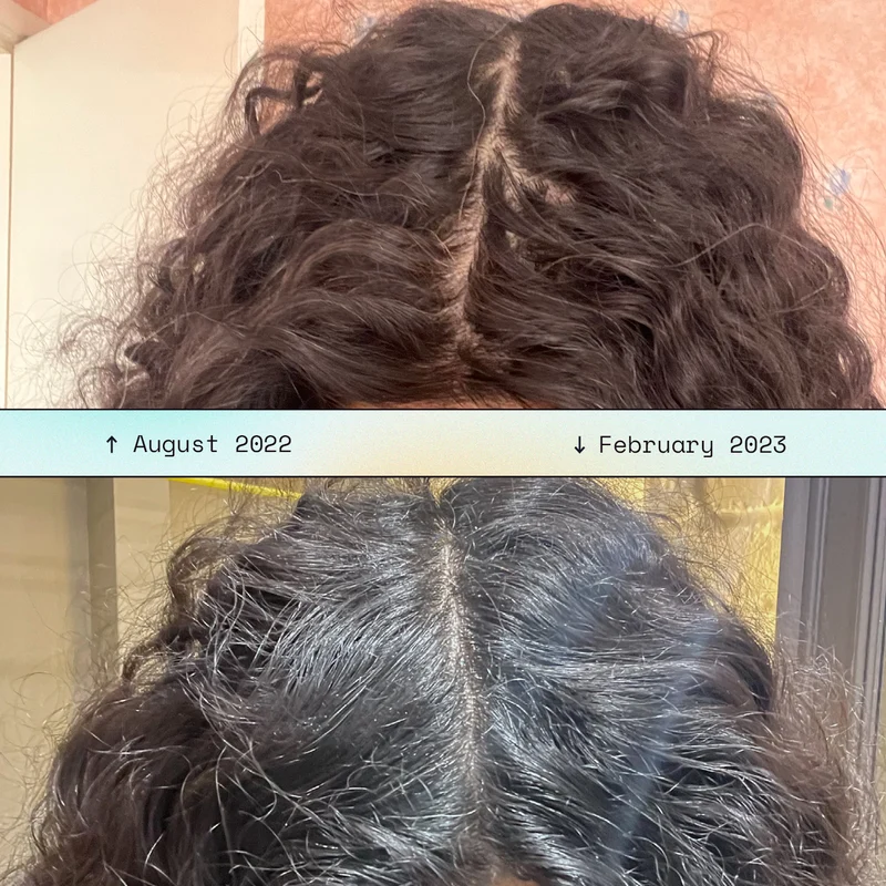 Hair Scalp Massager