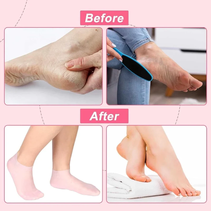 Moisture-Boost Healing Socks
